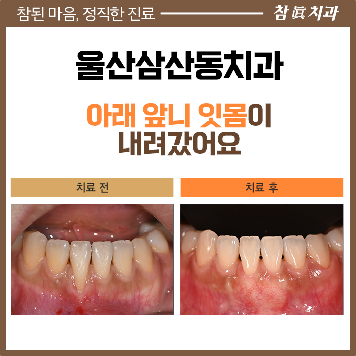 울산삼산동치과