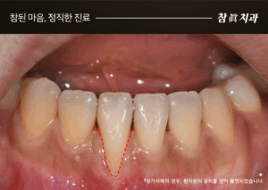 울산삼산동치과