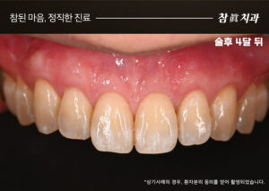 울산삼산동치과