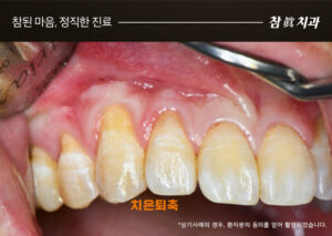 울산삼산동치과