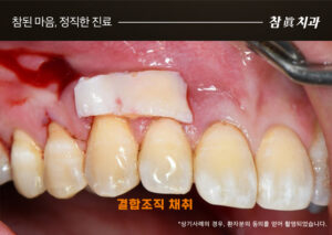 울산삼산동치과