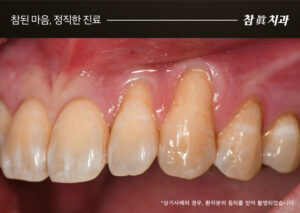 울산삼산동치과