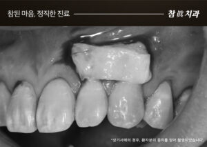 울산삼산동치과