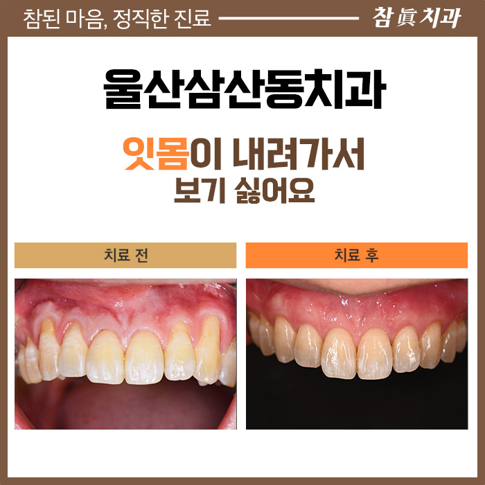 울산삼산동치과