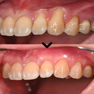 울산삼산동치과