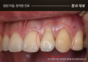 울산삼산동치과