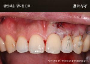 울산삼산동치과