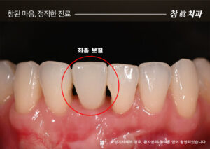 울산삼산동치과
