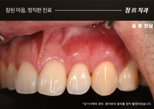 울산삼산동치과