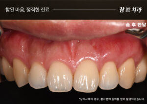 울산삼산동치과