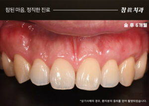 울산삼산동치과