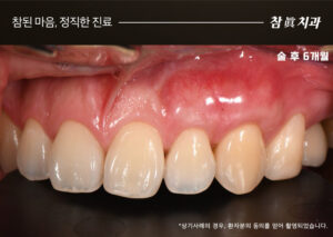 울산삼산동치과