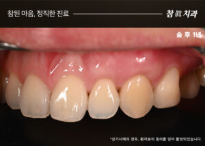 울산삼산동치과