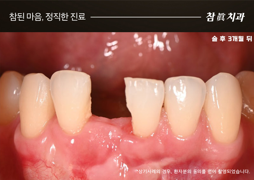 울산삼산동치과