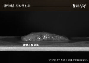 울산삼산동치과