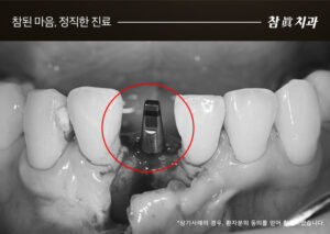 울산삼산동치과