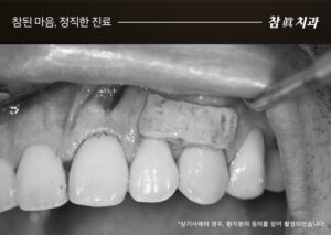 울산삼산동치과