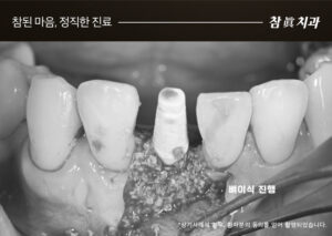 울산삼산동치과