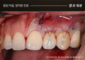 울산삼산동치과