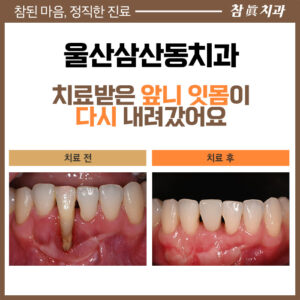 울산삼산동치과