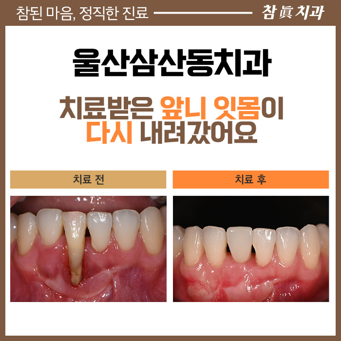 울산삼산동치과