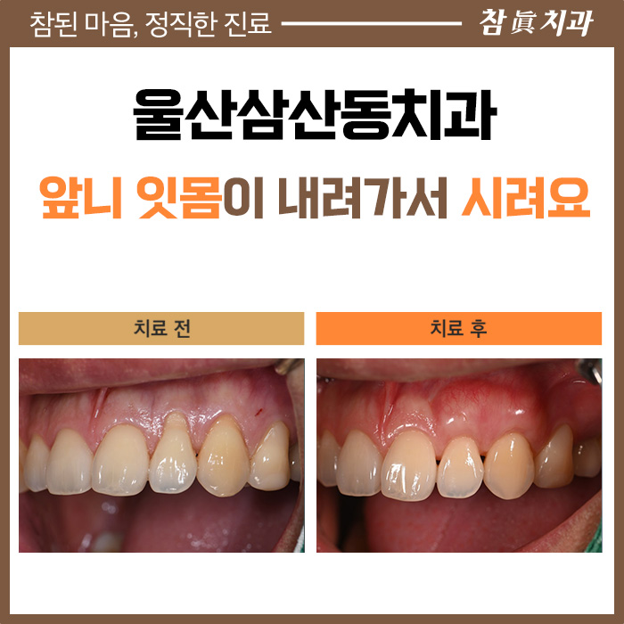 울산삼산동치과