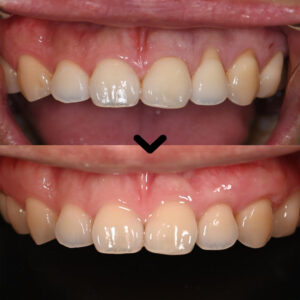 울산삼산동치과