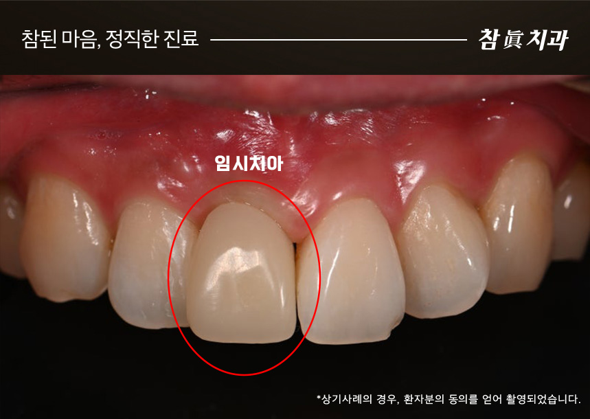 삼산동임플란트