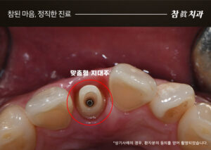 삼산동임플란트