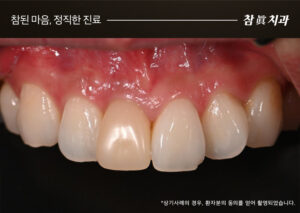 삼산동임플란트