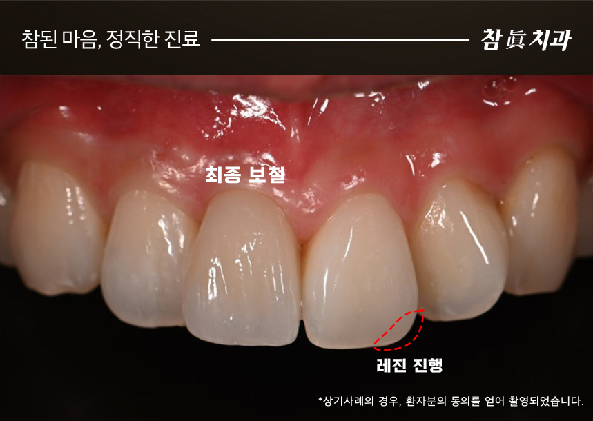 삼산동임플란트