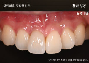 삼산동임플란트