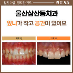 울산삼산동치과