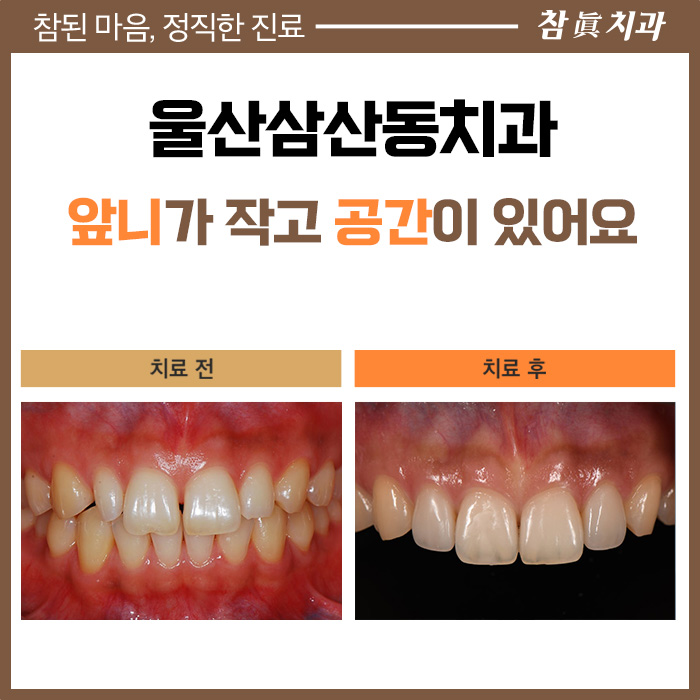 울산삼산동치과