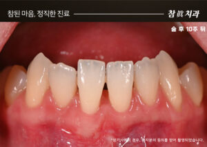 울산삼산동치과