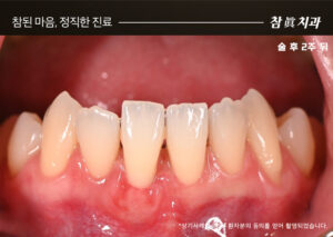 울산삼산동치과