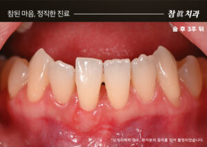 울산삼산동치과