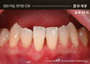 울산삼산동치과