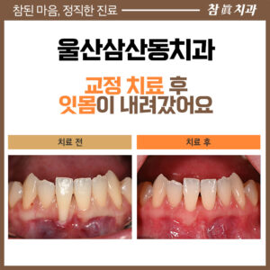 울산삼산동치과