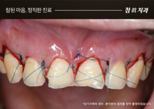 울산삼산동치과