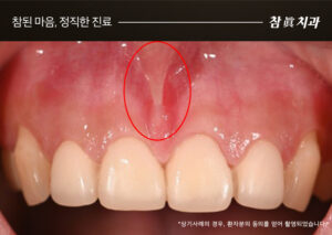 울산삼산동치과