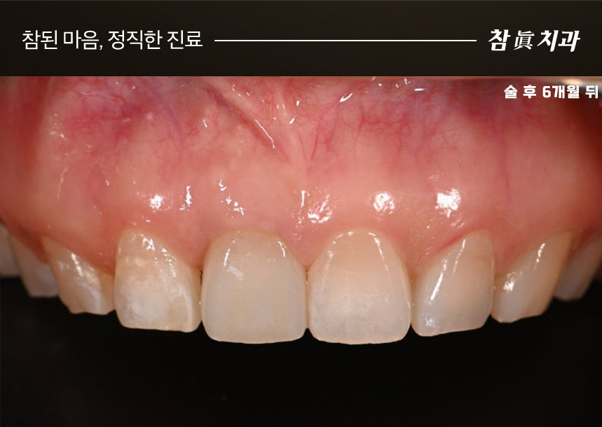 울산삼산동치과