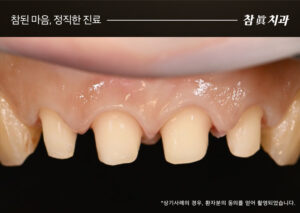 울산삼산동치과