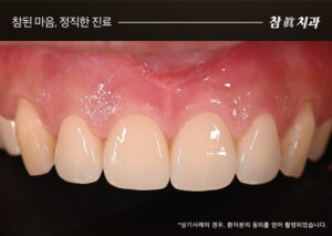 울산삼산동치과