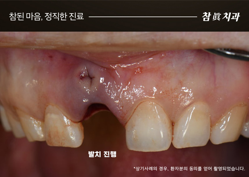 울산삼산동치과