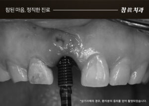 울산삼산동치과