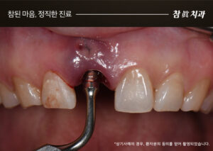 울산삼산동치과