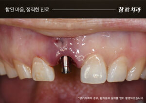 울산삼산동치과