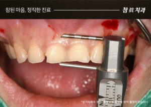 울산삼산동치과