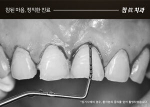울산삼산동치과
